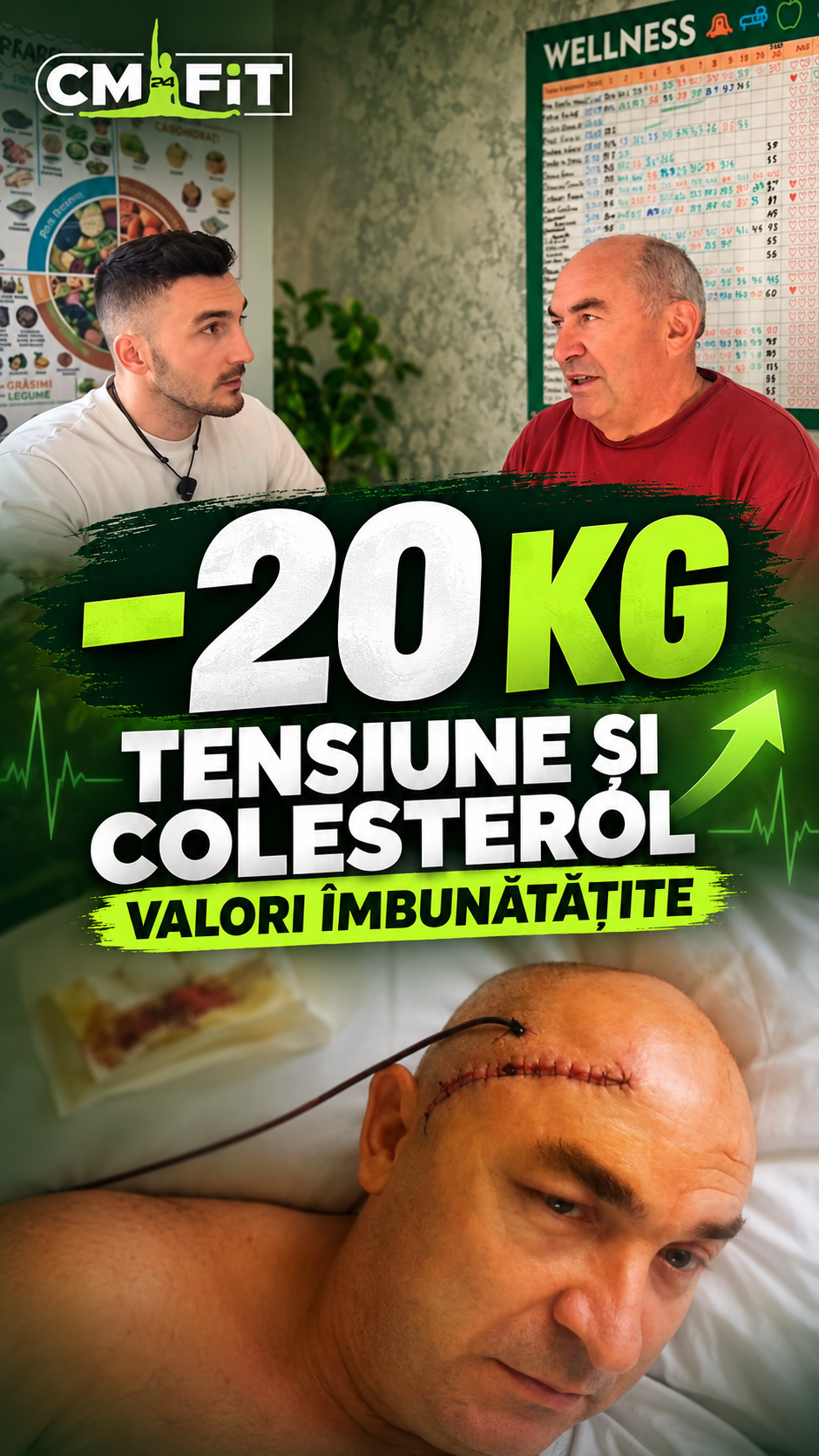 Ilie Mitea - (tata) — Tata a fost la un pas de un anevrism cerebral, pe fondul tensiunii arteriale și al colesterolului crescut. ❤️ Dar am decis să luptăm împreună! A slăbit 20 de kilograme, și-a îmbunătățit analizele și astăzi ne bucurăm în continuare de viață, împreună. Pentru mine, acesta este cel mai frumos rezultat: nu doar kilograme pierdute, ci timp câștigat alături de oamenii pe care îi iubim. 🙏